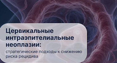 Цервикальные интраэпителиальные неоплазии: стратегические подходы к снижению риска рецидива